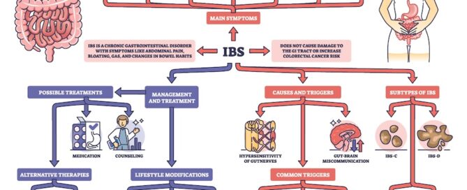 Irritable Bowel Syndrome (IBS) Diagnosis and Treatment Graphic