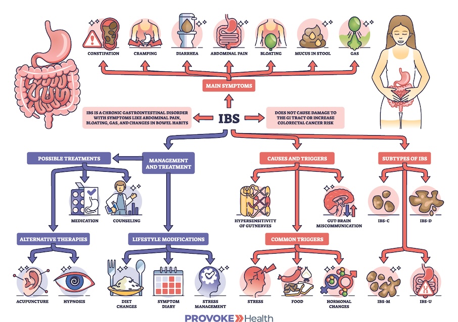 Irritable Bowel Syndrome (IBS) Diagnosis and Treatment Graphic